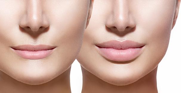 botox toluca, rejuvenecimiento facial, arrugas, dermatólogos en toluca