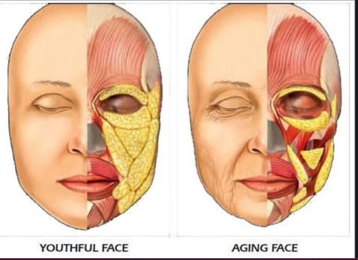 relleno de rostro con hialuronico clinica franco